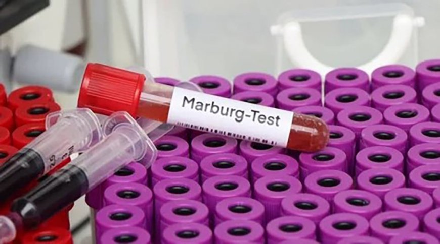 Explainer: The origin of Marburg virus, name and nature --[Reported by Umva mag]