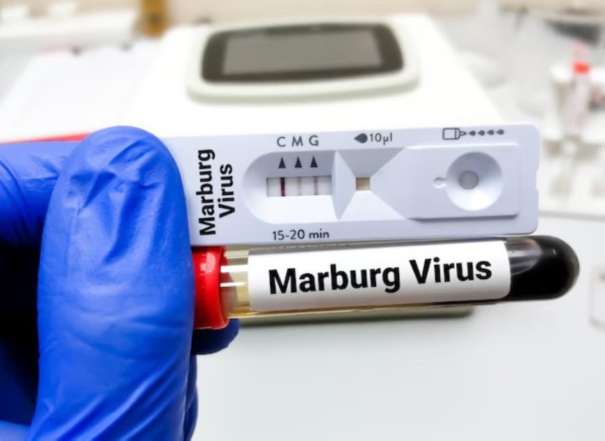 Marburg virus: 11 fatalities reported as seven new cases are confirmed --[Reported by Umva mag]