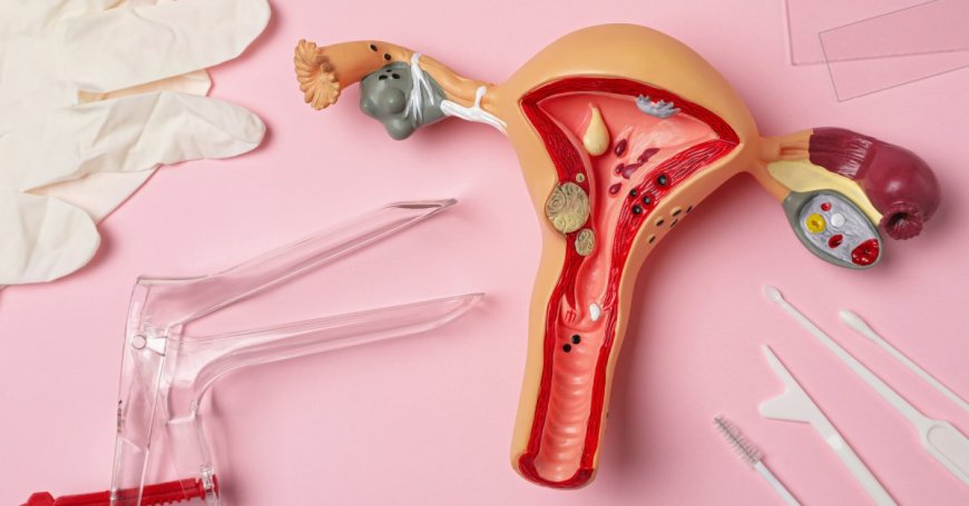 What to Expect at a Pap Smear --[Reported by Umva mag]