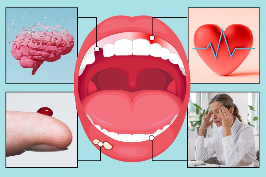 The 10 things your TEETH can reveal about your health – from silent killers to dementia --[Reported by Umva mag]