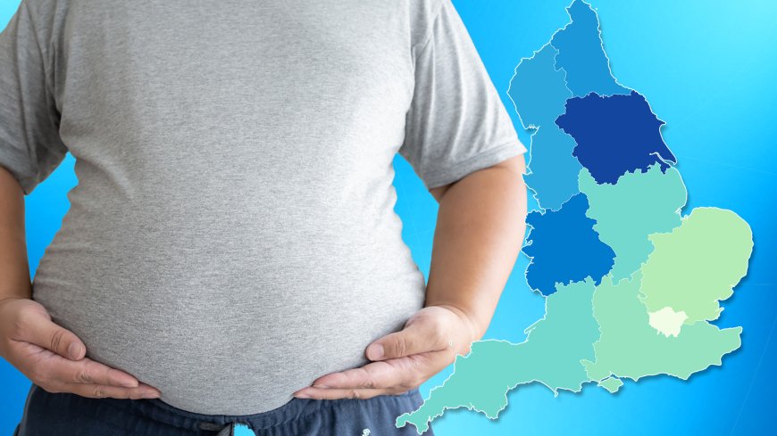 Interactive map reveals obesity capital of the UK where 70% of people are obese – where does your area rank? --[Reported by Umva mag]