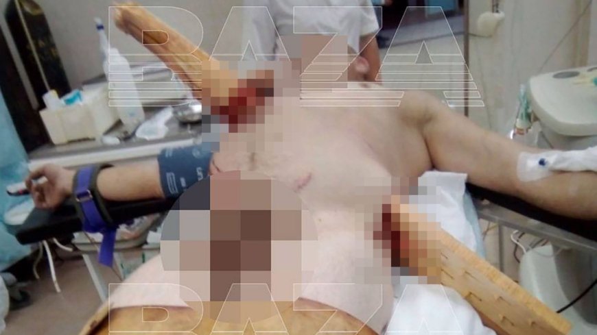 Shock pic shows Russian prisoner left SKEWERED on huge wooden stake that pierced through his torso after freak accident --[Reported by Umva mag]