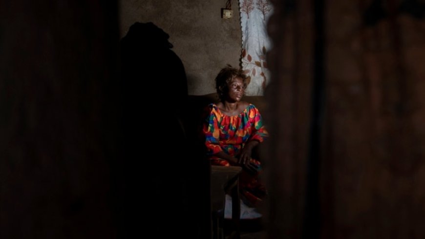 Sex workers find themselves at center of Congo's mpox outbreak --[Reported by Umva mag]