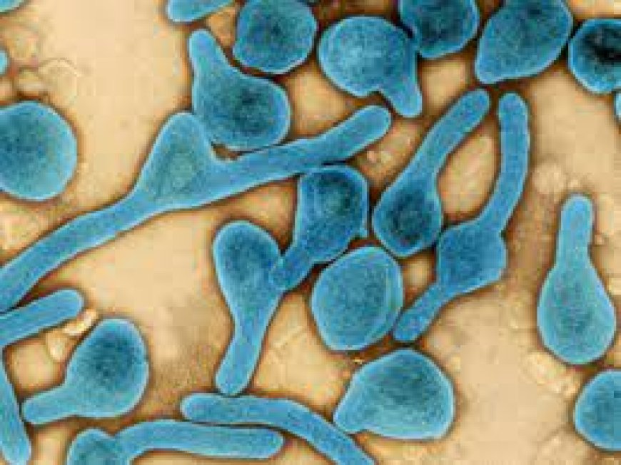 Marburg virus: East Africa urged to coordinate response --[Reported by Umva mag]