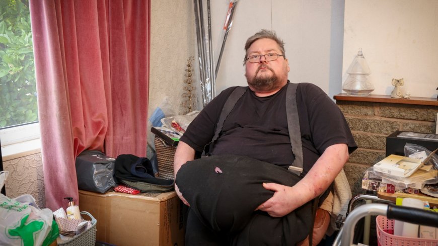 I’ve got a huge FIVE-STONE growth hanging off my stomach but doctors refuse to remove it – my life is hell --[Reported by Umva mag]