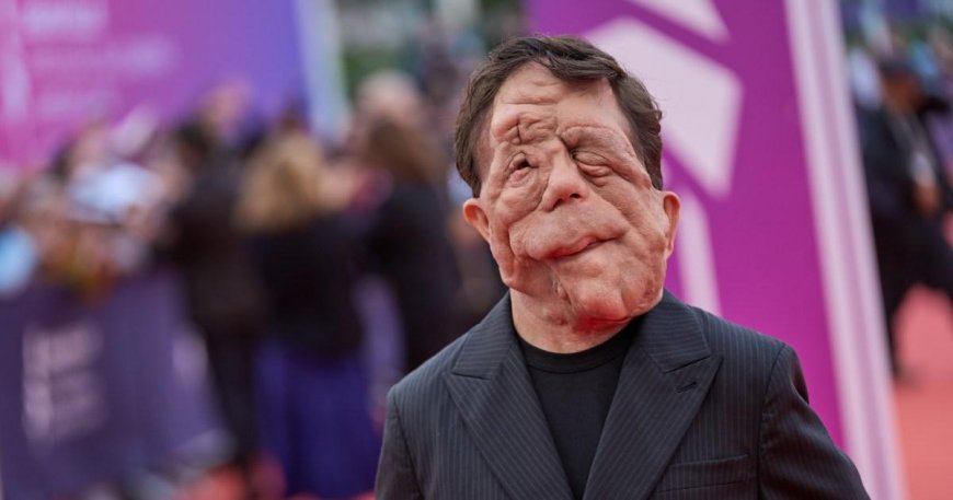 A Different Man star Adam Pearson ‘didn’t think disabled people were allowed in films’ --[Reported by Umva mag]