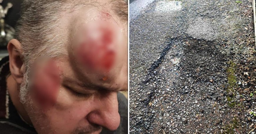 Grandad ‘broke spine and smashed face’ after tripping on gaping pothole --[Reported by Umva mag]