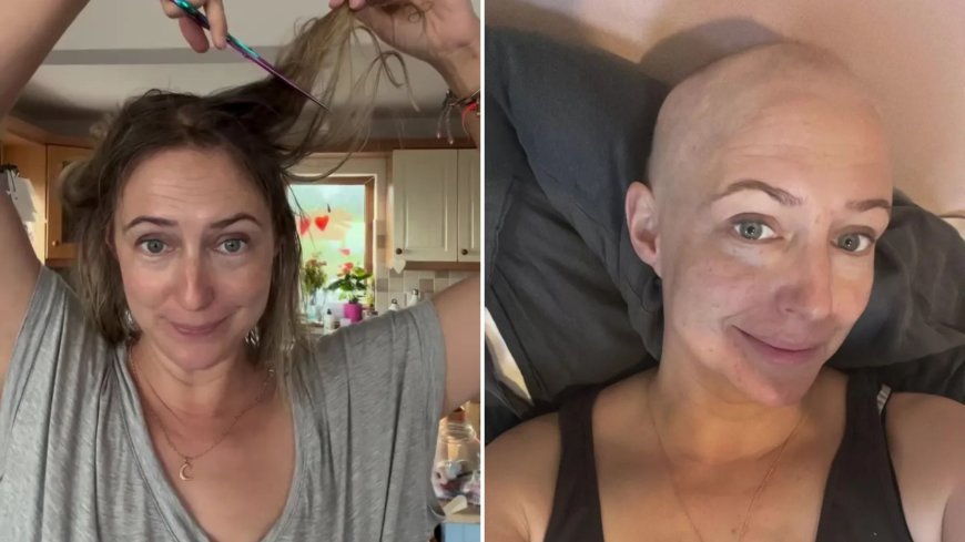 Hollyoaks star Ali Bastian shaves her head in emotional video amid cancer battle --[Reported by Umva mag]