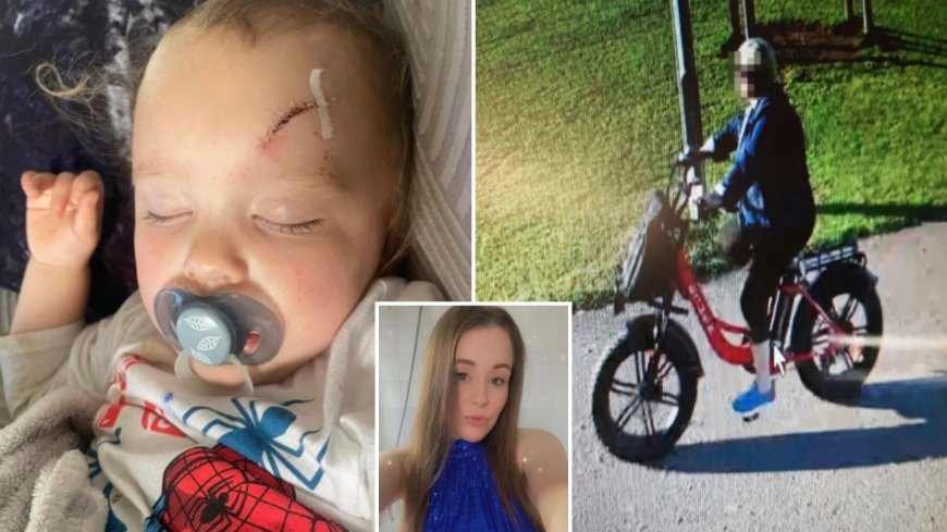 My son, 2, was hit by e-bike rider on footpath – he had 12 stitches but SHE was let off by cops who returned her bike --[Reported by Umva mag]